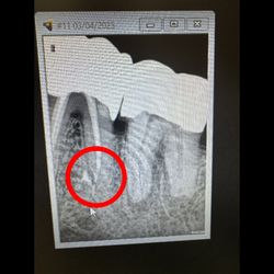 Colorado West Endodontics