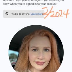 A Fresh Face Aesthetics - After photo