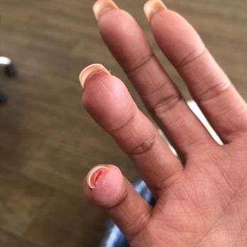 Allure Nail Lounge - Cut my nail too short and I couldn't stop bleeding. Owner didn't even look sorry for doing it. - Nail Salons Near Me - Mission Viejo, California Allure Nail Lounge - Cut my nail too short and I couldn't stop bleeding. Owner didn't even look sorry for doing it. - Nail Salons Near Me - Mission Viejo, California
