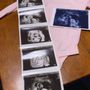 Bond with Baby Ultrasound