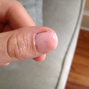 David Michael Salon and Day Spa - Aftermath of the nail disaster. - Day Spas Near Me - Simpsonville, South Carolina