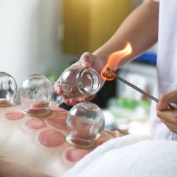 Ariya Thai Massage & Day Spa - Hot Cupping- Traditional Chinese Medicine Treatment. Call our spa @310-869-9437 for appointment with Dr.Sun