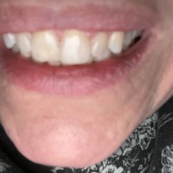 Wen-hui Liu , DDS - Teeth