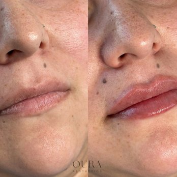 Katie Estes - Medical Spas Near Me - Monterey, California
