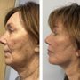 Photo of Skin & Vein - West