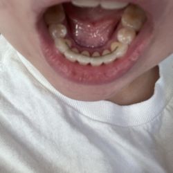 Amrit Burn, DDS, MSD