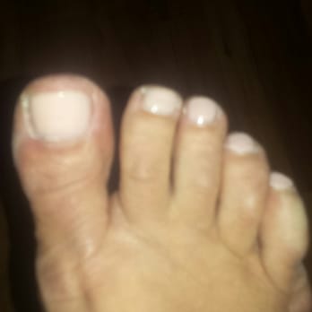 Paris Salon & Day Spa - Pedi 24 hours later - Day Spas Near Me - Tampa, Florida Paris Salon & Day Spa - Pedi 24 hours later - Day Spas Near Me - Tampa, Florida