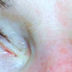 Natural Synergy Day Spa - Volume Lashes