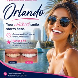 Maui Whitening - Orlando