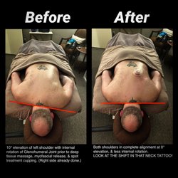 Visible results are possible in just one treatment.