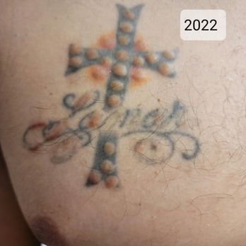 Embassy Tattoo - Next year, was told they can't cover it until the skin heals more. - Piercing Near Me - Washington, DC, District of Columbia