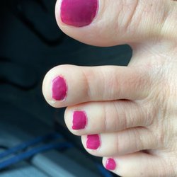 Lv nail