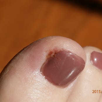 Campbell Nails & Spa - Don't let this happen to you @ Campbell Nails & Spa. They do this and take your money anyway. - Nail Salons Near Me - Campbell, California Campbell Nails & Spa - Don't let this happen to you @ Campbell Nails & Spa. They do this and take your money anyway. - Nail Salons Near Me - Campbell, California