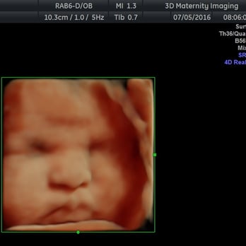 3D Maternity Imaging - 38 WEEK BABY BOY! - Diagnostic Imaging Near Me - New Hyde Park, New York 3D Maternity Imaging - 38 WEEK BABY BOY! - Diagnostic Imaging Near Me - New Hyde Park, New York