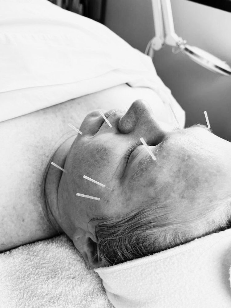 VEGAS ACUPUNCTURE THERAPY 19 Reviews 2520 St Rose Pkwy, Henderson