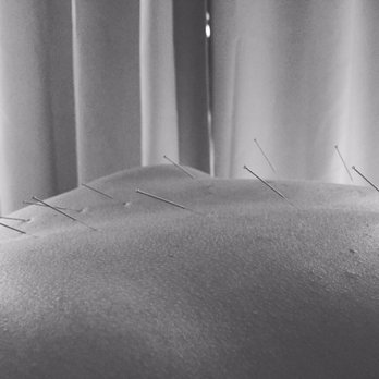 Haven Wellbeing - Acupuncture Near Me - Miami Beach, Florida
