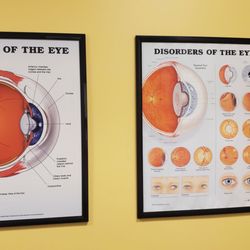 Pearle Vision