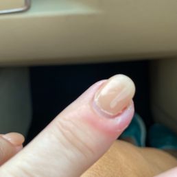 finger infection.. thanks for that! finger infection.. thanks for that!