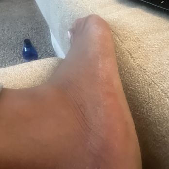 Endless Nail & Spa - Is this a fine pedicure to you? NO! - Nail Salons Near Me - Smyrna, Georgia