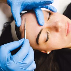 Dermaplaning