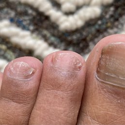 Sorry for the gross toe pic but wanted to show how the polish is still not completely removed after WEEKS of trying!!! Sorry for the gross toe pic but wanted to show how the polish is still not completely removed after WEEKS of trying!!!