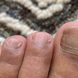 Royal Nails Spa - Sorry for the gross toe pic but wanted to show how the polish is still not completely removed after WEEKS of trying!!!