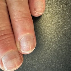 Nails By Michael - Damaged Nails