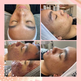 The Lash And Body Bar - Skin Care Near Me - Las Vegas, Nevada The Lash And Body Bar - Skin Care Near Me - Las Vegas, Nevada