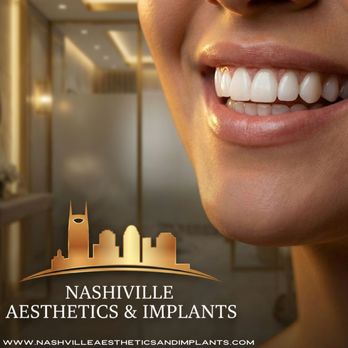 Nashville Aesthetics & Implants - Cosmetic Dentists Near Me - Nashville, Tennessee Nashville Aesthetics & Implants - Cosmetic Dentists Near Me - Nashville, Tennessee