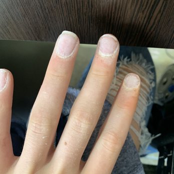 Nails Alert - This picture is THE FINAL PRODUCT. She told me to get up and go wash my hands. IM ON CRUTCHES. - Nail Salons Near Me - Chicago, Illinois Nails Alert - This picture is THE FINAL PRODUCT. She told me to get up and go wash my hands. IM ON CRUTCHES. - Nail Salons Near Me - Chicago, Illinois