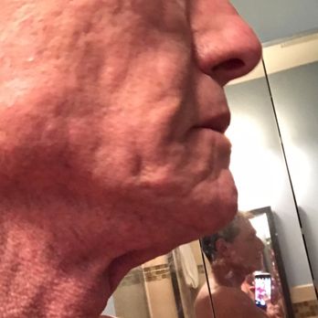 Paul Wigoda, MD - 7 - Cosmetic Surgeons Near Me - Fort Lauderdale, Florida Paul Wigoda, MD - 7 - Cosmetic Surgeons Near Me - Fort Lauderdale, Florida