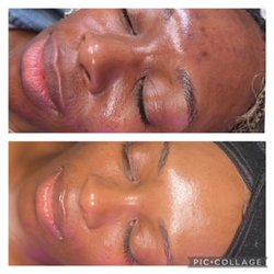 360 Health Integrated Medical Boutique - Sken Care at its finest at our Sken Fetysh hub.. join us if you wan to have a more radiant appearance