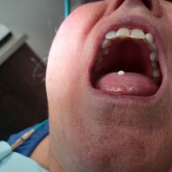Beautiful Smiles by Design - Implant.