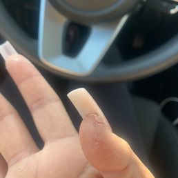 Acrylic under my nail Acrylic under my nail