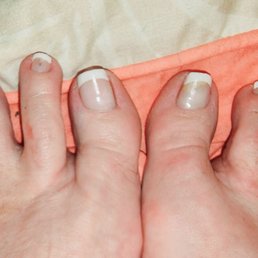 Finally have found THE perfect pedi, French tip!! Finally have found THE perfect pedi, French tip!!