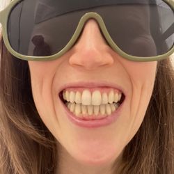 Bella Smile - Finished Invisalign Sept 19th 2023