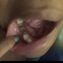 Incomplete implant procedure. Procedure begin in Dec 2019, 2020 Pandemic, Apr 2021 asked for records and in a month still don't have them. Incomplete implant procedure. Procedure begin in Dec 2019, 2020 Pandemic, Apr 2021 asked for records and in a month still don't have them.