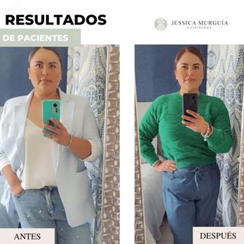 Nutrióloga Jessica Murguía - Paciente: Irianna P.
Objetivo: Pérdida de peso (11 kg)
Tiempo: 8 meses
Nota: Alti bajos, problemas hormonales femeninos, pero al f - Nutritionists Near Me - Tijuana, BCN Nutrióloga Jessica Murguía - Paciente: Irianna P.
Objetivo: Pérdida de peso (11 kg)
Tiempo: 8 meses
Nota: Alti bajos, problemas hormonales femeninos, pero al f - Nutritionists Near Me - Tijuana, BCN