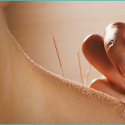 Arundel Acupuncture