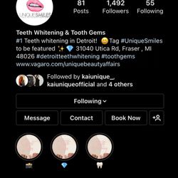 Unique Beauty Affairs - Teeth whitening and tooth gems with @_UniqueSmiles