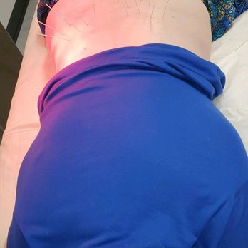 Northridge Acupuncture - Acupuncture treatment for lower back and knee by Dr. Lu. - Acupuncture Near Me - Reseda, California Northridge Acupuncture - Acupuncture treatment for lower back and knee by Dr. Lu. - Acupuncture Near Me - Reseda, California