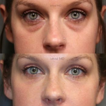 Thomas Dermatology - Dermatologists Near Me - Henderson, Nevada Thomas Dermatology - Dermatologists Near Me - Henderson, Nevada