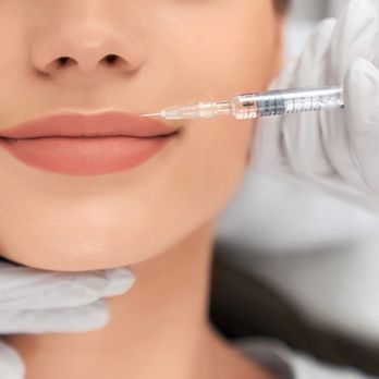 Bella Spa - Lip Filler - Tattoo Removal Near Me Bella Spa - Lip Filler - Tattoo Removal Near Me