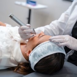 Look Lab Med Spa - Microneedling treatment is a great choice for those with acne scars and conditions resulting in uneven skin texture or appearance.