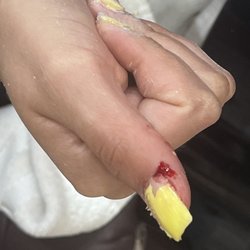 Beautiful Nails - During the acrylic removal