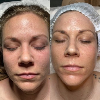 AME's Skin Therapy - Hair Removal Near Me - Fort Worth, Texas
