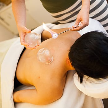 Annie Wang Acupuncture - Cupping is a great way to promote circulation in targeted areas of the body to relieve pain. Also used to reduce cold symptoms. - Acupuncture Near Me - Los Altos, California Annie Wang Acupuncture - Cupping is a great way to promote circulation in targeted areas of the body to relieve pain. Also used to reduce cold symptoms. - Acupuncture Near Me - Los Altos, California
