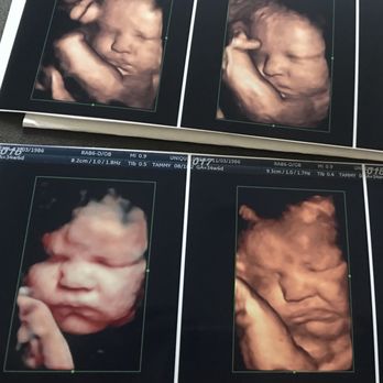 Unique Ultrasound - Diagnostic Imaging Near Me - Temecula, California Unique Ultrasound - Diagnostic Imaging Near Me - Temecula, California