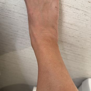 Hyatt Regency Irvine - My leg and foot all bitten up- I won't post a picture of my back and abdomen... - Hotels Near Me - Irvine, California