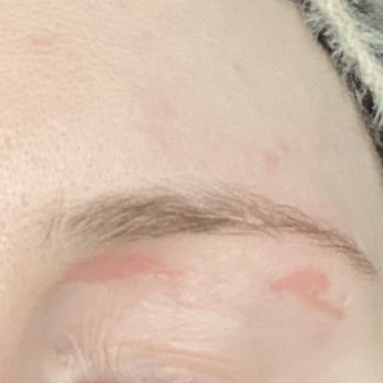 Glory Nail and Spa - The other side. Not nearly as bad, but again, it's going to scab, and that sucks. - Nail Salons Near Me - Lubbock, Texas